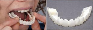 连续几颗牙缺失能做全瓷牙吗
